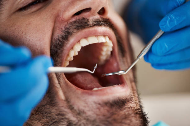 Best Emergency Dental Extractions in Kenmar, PA