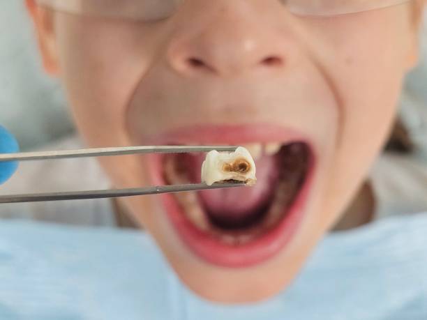 Best Emergency Dental Care for Abscessed Tooth in Kenmar, PA
